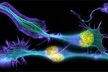 LIFE MAGNIFIED - VIDA AMPLIADA