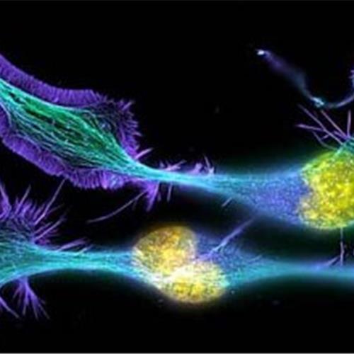 LIFE MAGNIFIED - VIDA AMPLIADA 